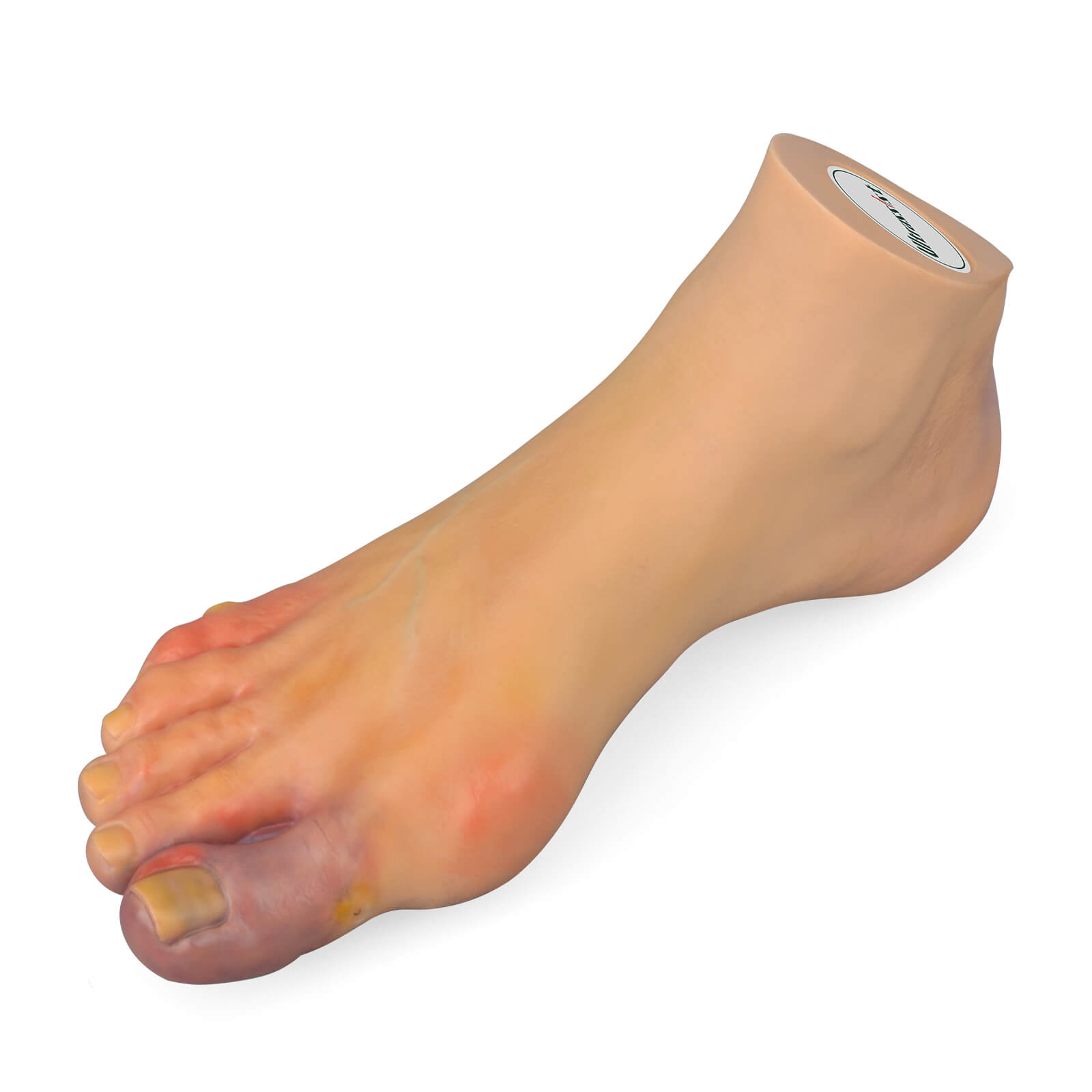 Foot Pathology Model with Common Foot Conditions