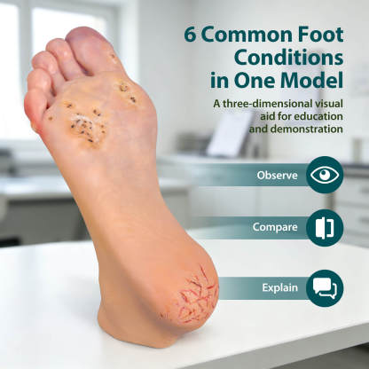 Foot Pathology Model with Common Foot Conditions