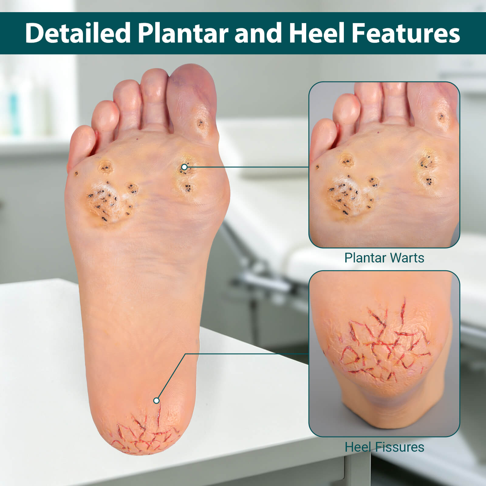 Foot Pathology Model with Common Foot Conditions