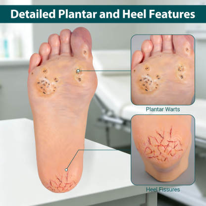 Foot Pathology Model with Common Foot Conditions