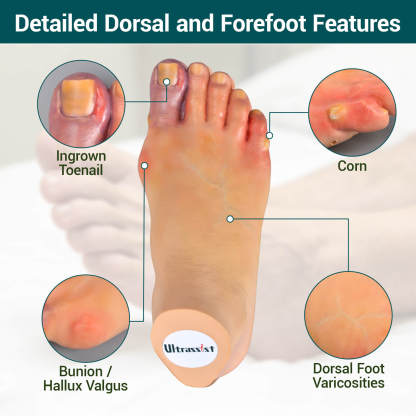 Foot Pathology Model with Common Foot Conditions