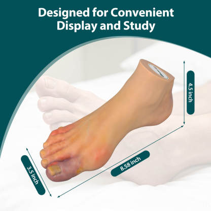 Foot Pathology Model with Common Foot Conditions