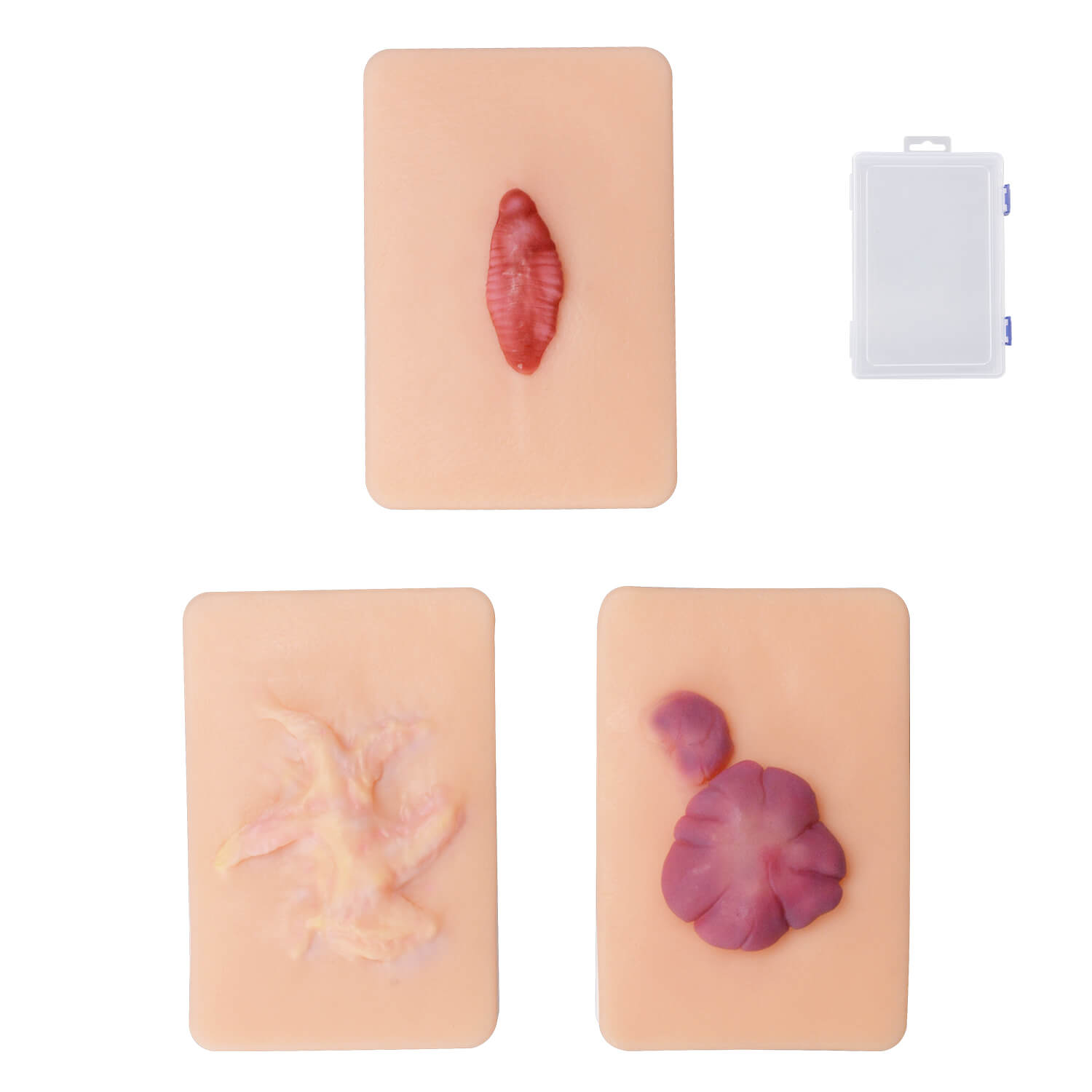 Pocket Hypertrophic & Keloid Scar Simulation Models