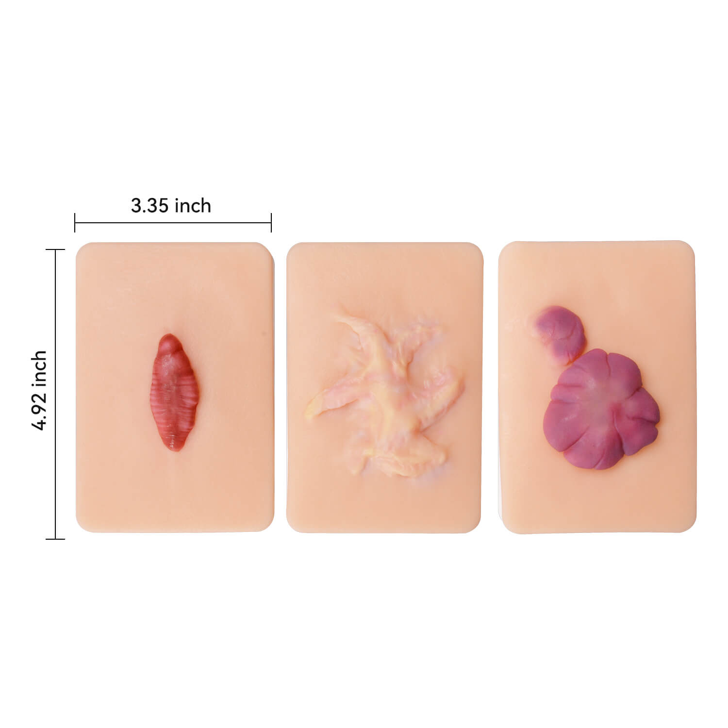 Hypertrophic & Keloid Scar Simulation Models Size