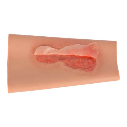 Abrasion Wound Care Training Sleeve