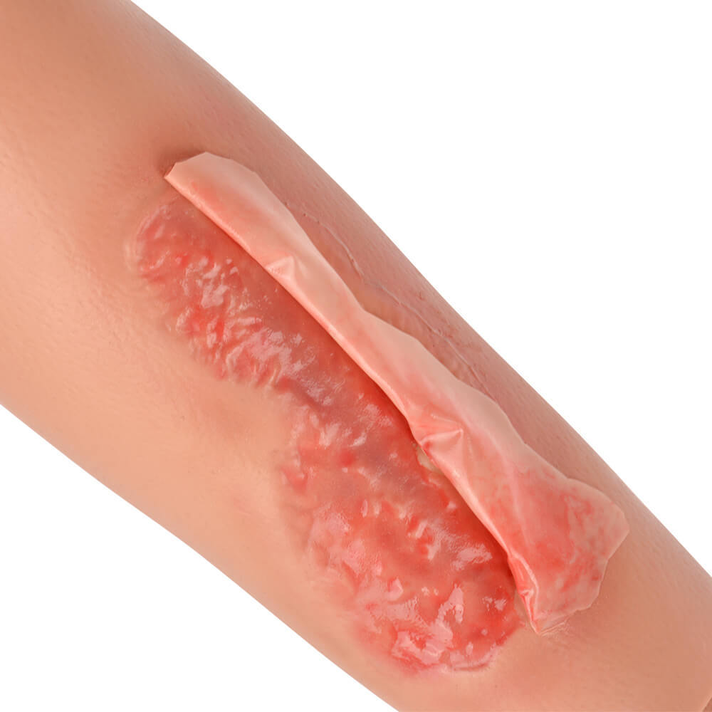 Abrasion Wound Care Training Sleeve