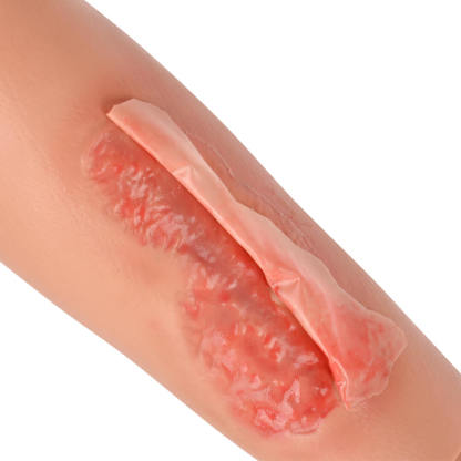 Abrasion Wound Care Training Sleeve