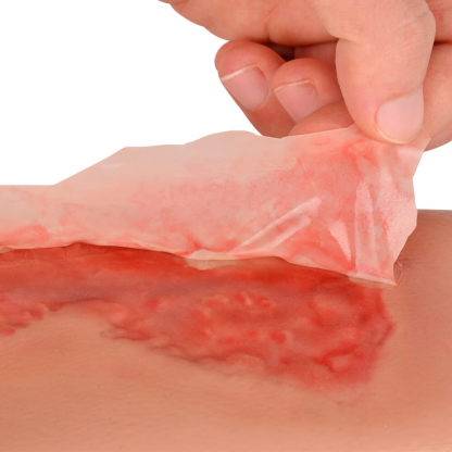 Abrasion Wound Care Training Sleeve