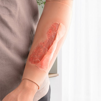 Abrasion Wound Care Training Sleeve
