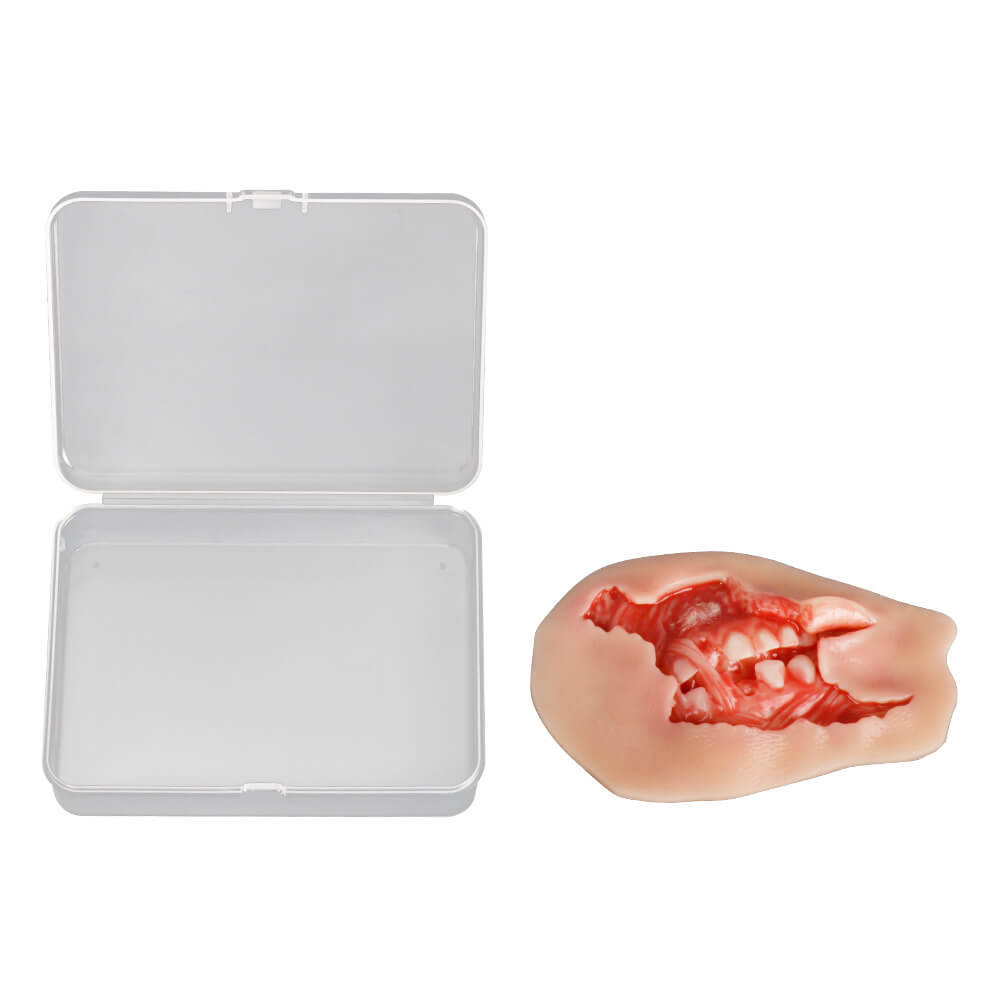 Adhesive Exposed Denture Avulsion Wound Moulage