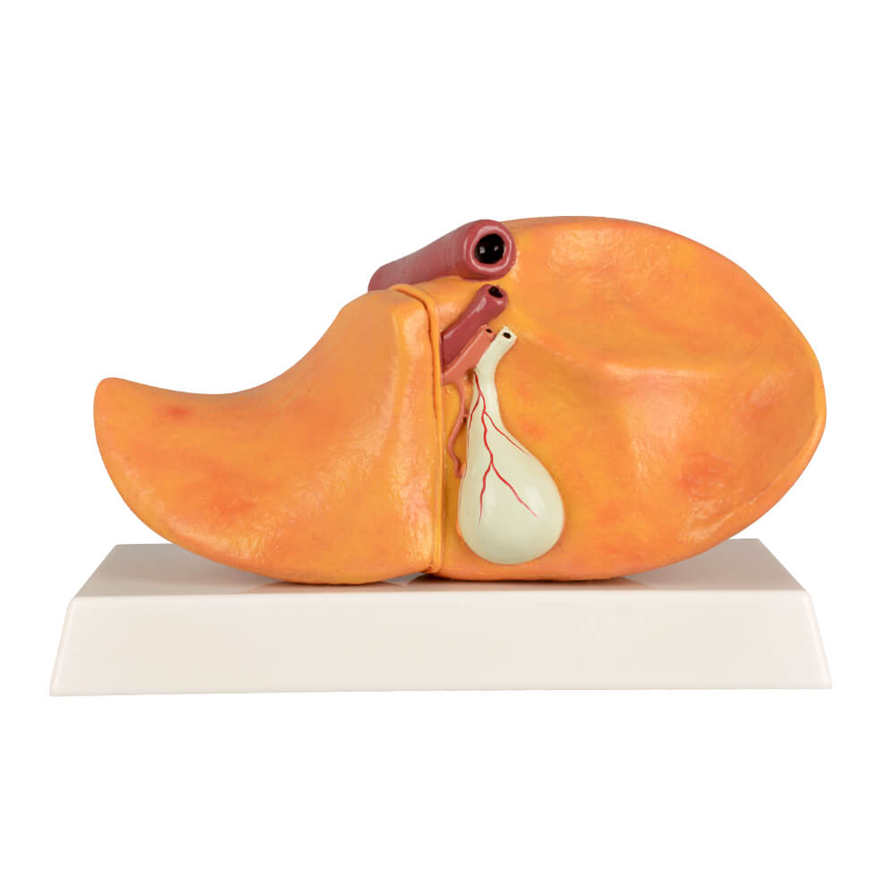 Alcoholic Fatty Liver Model with Gall Bladder
