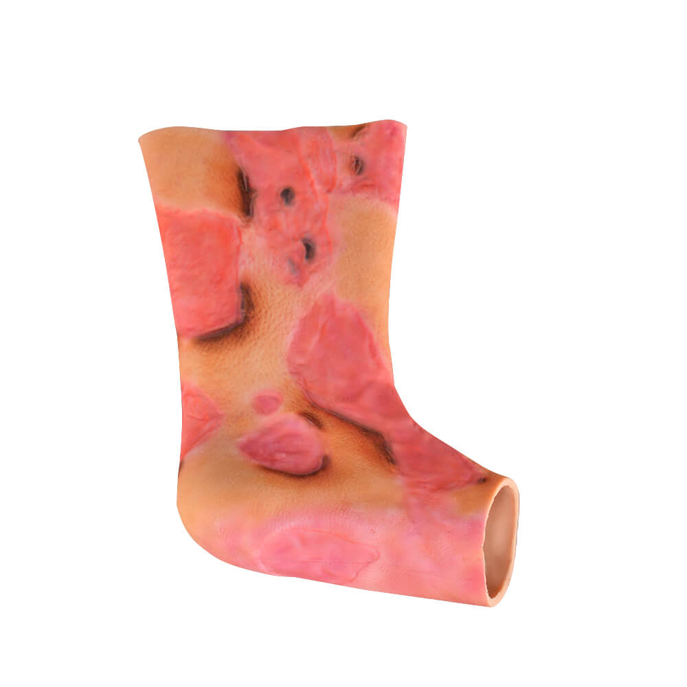 Ankle & Lower Leg Burn Simulation Sleeve