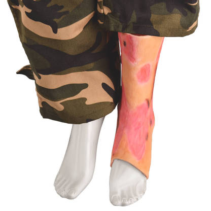Ankle & Lower Leg Burn Simulation Sleeve