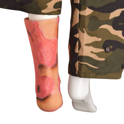 Ankle & Lower Leg Burn Simulation Sleeve