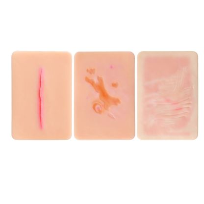 Atrophic Scar Wound Simulation Models (Set of 3)