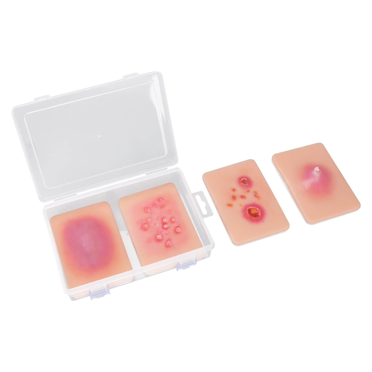 Bacterial Skin Infection Wound Simulation Models (Set of 4)