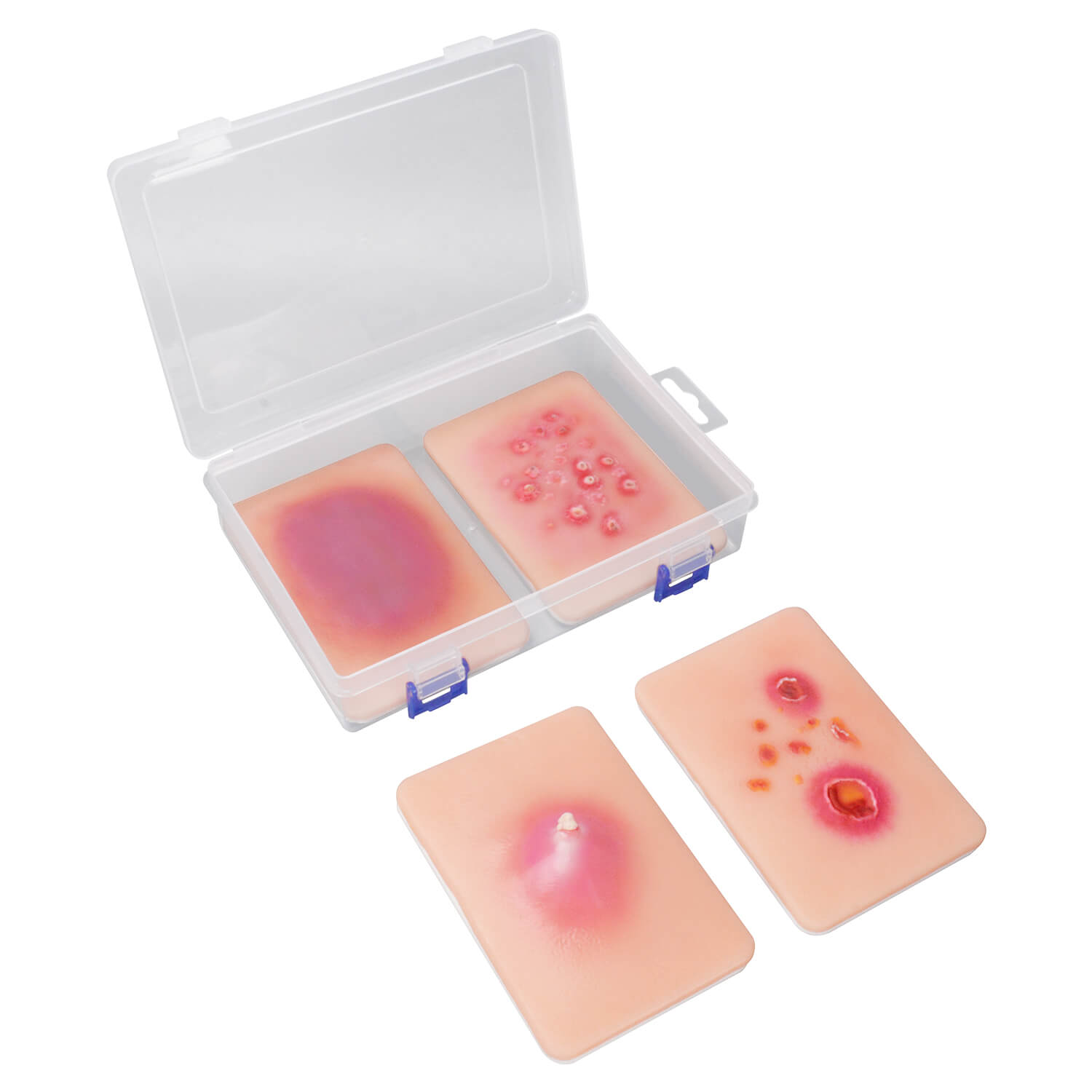 Bacterial Skin Infection Wound Simulation Models (Set of 4)