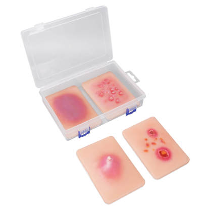 Bacterial Skin Infection Wound Simulation Models (Set of 4)