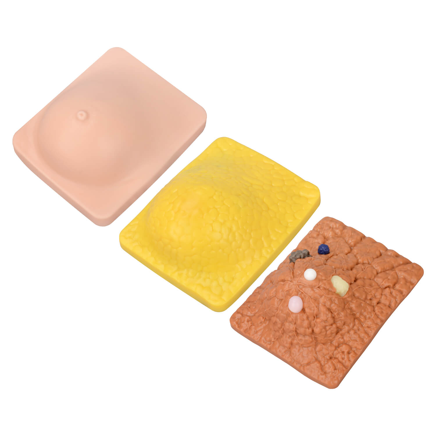 Breast Anatomy & Pathology Model with 5 Conditions