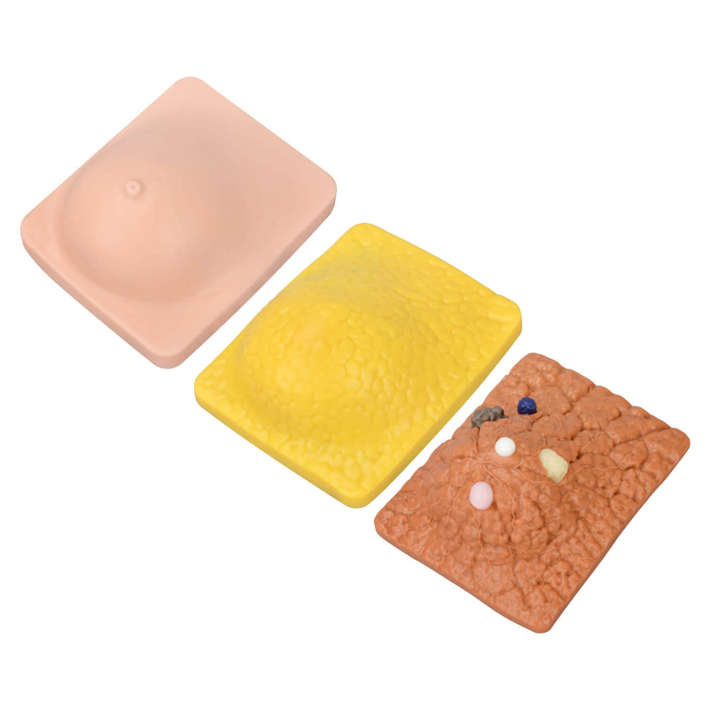 Breast Anatomy & Pathology Model with 5 Conditions