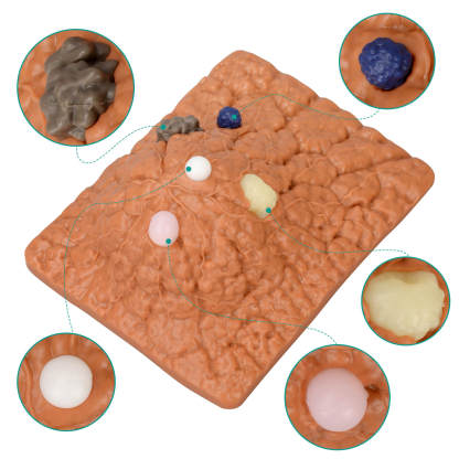 Breast Anatomy & Pathology Model with 5 Conditions