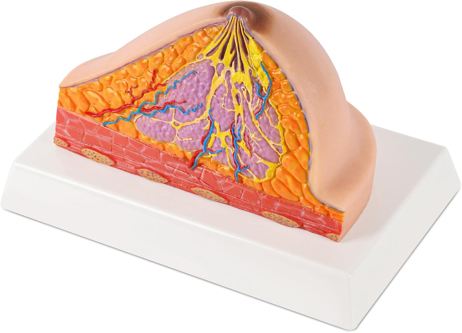 Ultrassist Silicone Breast Cross-Section Model - Female Breast Anatomy