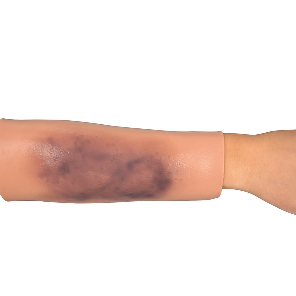 Bruise Wound Care Trainer, Sleeve Style