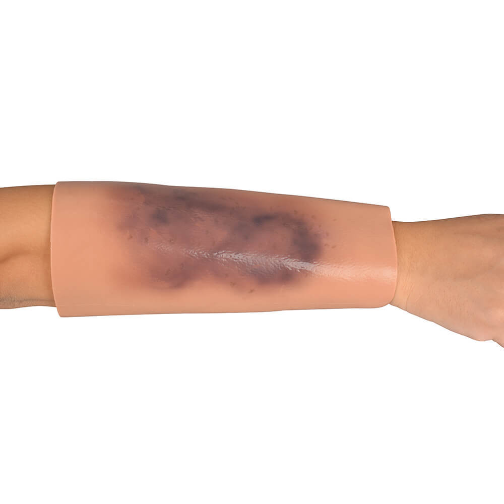 Bruise Wound Care Trainer, Sleeve Style