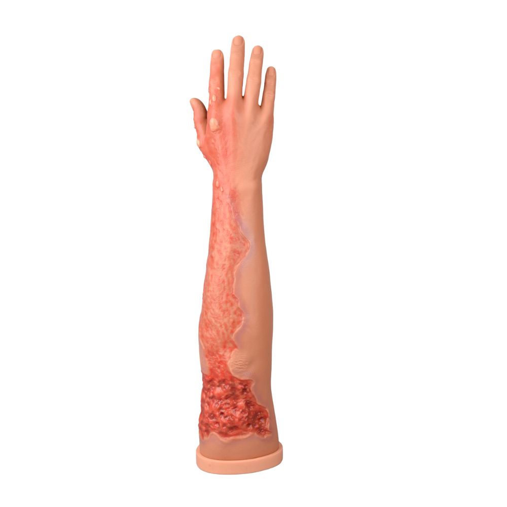Multi-Degree Burn Wound Arm Training Model