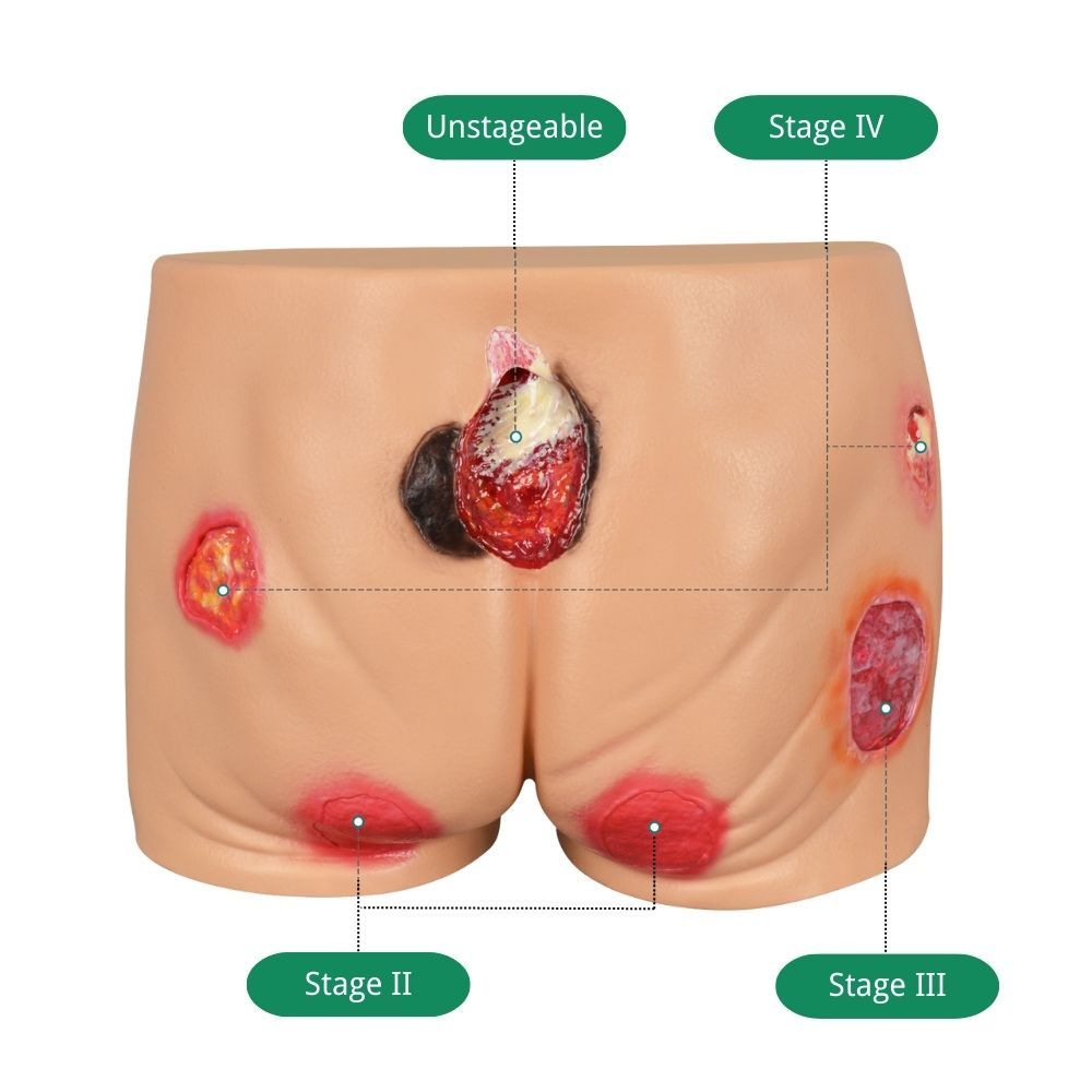 PVC Buttocks Pressure Ulcer Simulator for Nursing Education