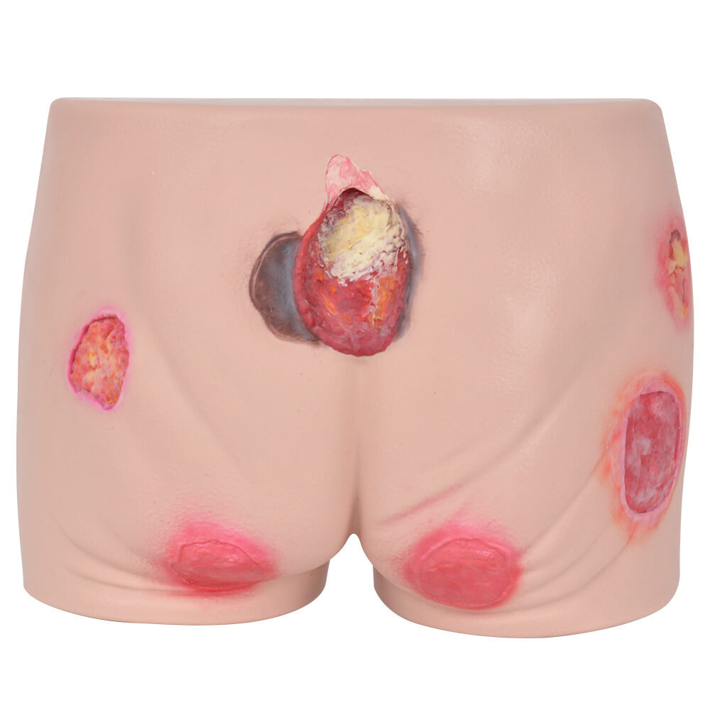 Buttocks Decubitus Wound Care Simulator