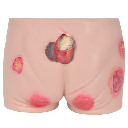 Buttocks Decubitus Wound Care Simulator