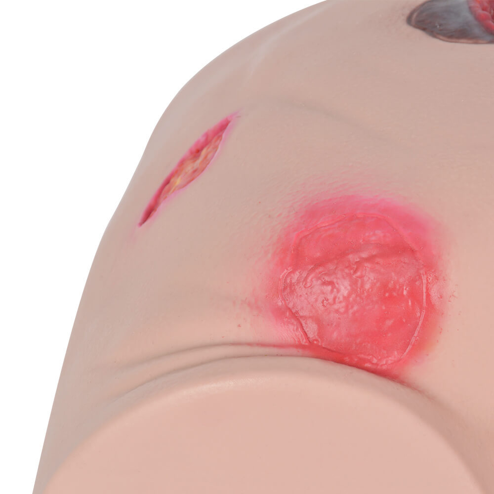 Buttocks Decubitus Wound Care Simulator