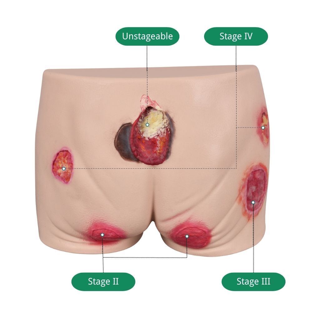 Buttocks Decubitus Wound Care Simulator