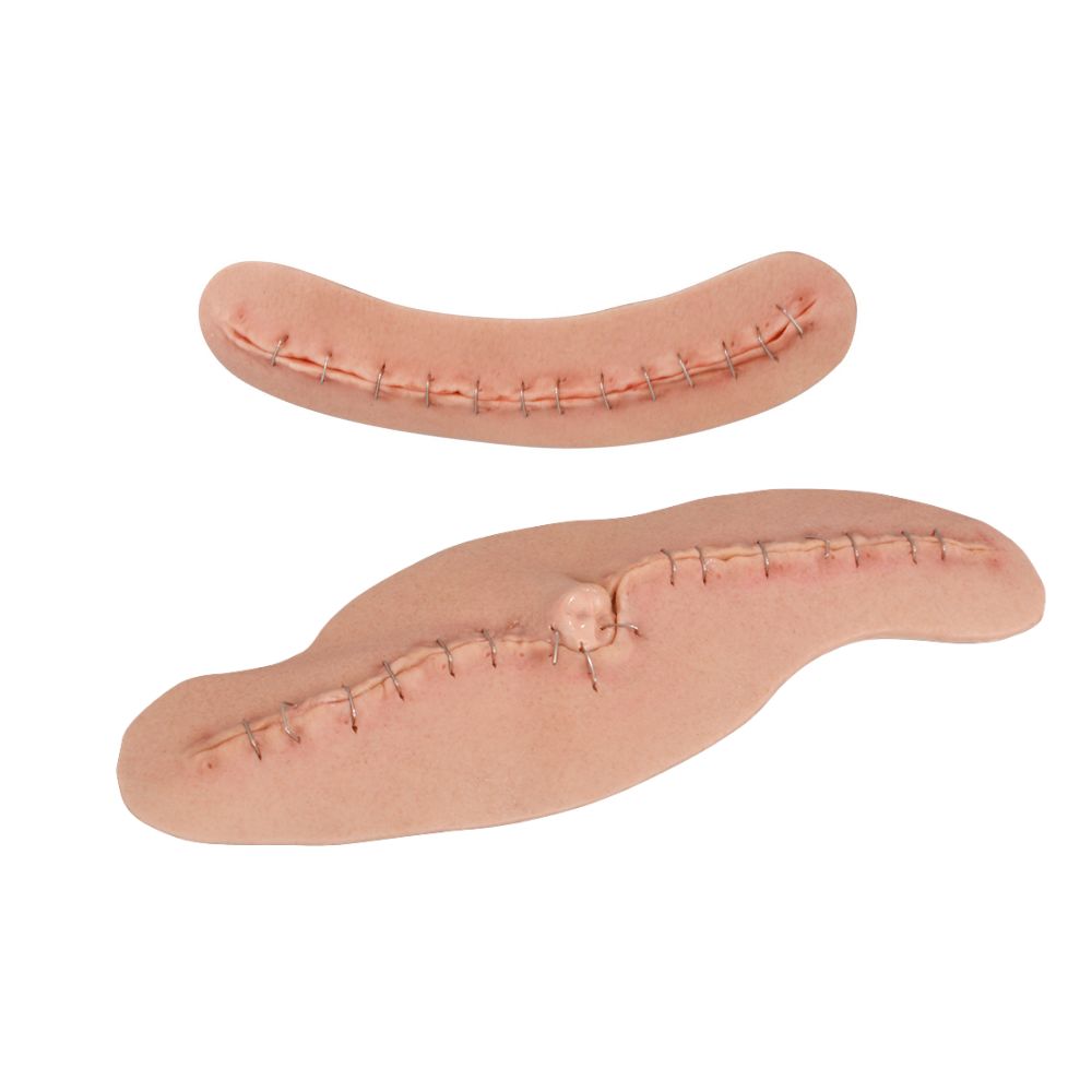 Adhesive C-Section Wound Model with Staples