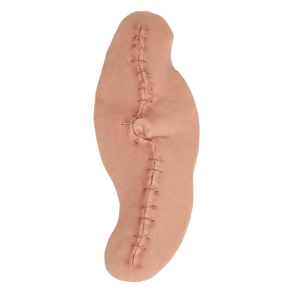 Adhesive C-Section Wound Model with Staples