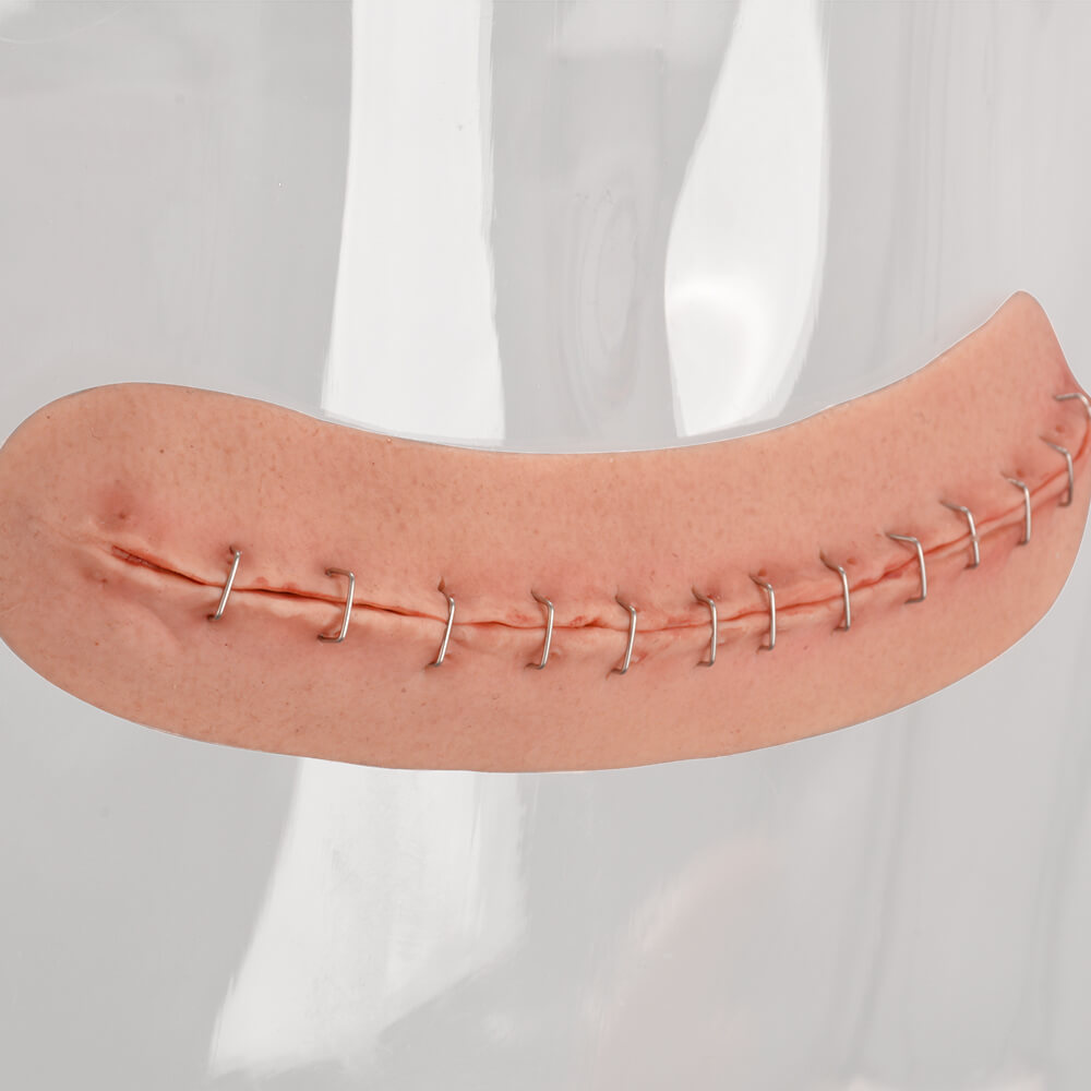 Adhesive C-Section Wound Model with Staples