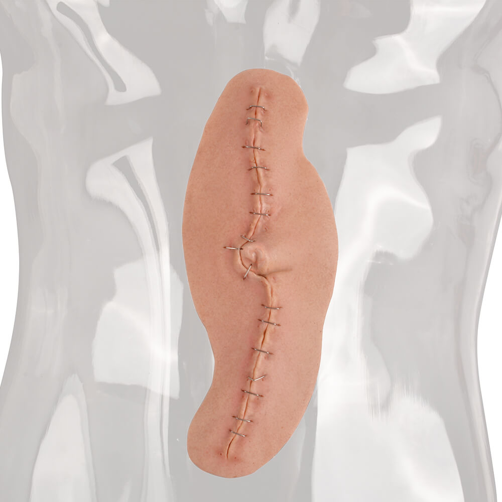 Adhesive C-Section Wound Model with Staples