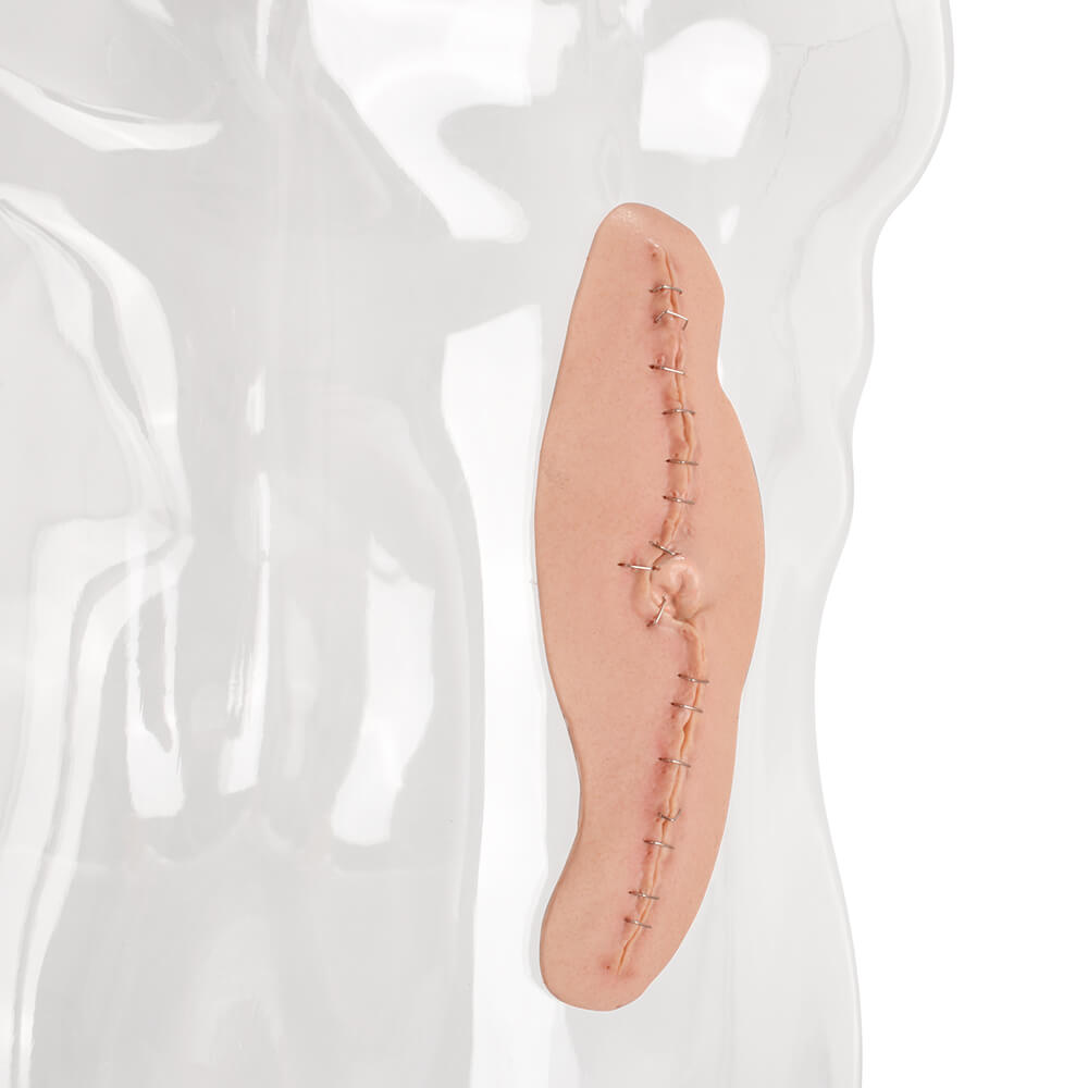 Adhesive C-Section Wound Model with Staples