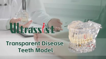 Transparent Disease Teeth Model with Dental Implant Bridge