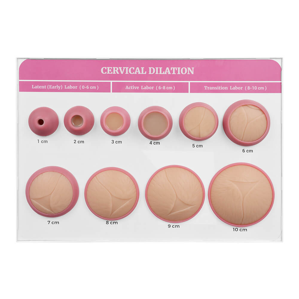 Cervical Dilatation and Effacement Models(10) with Easel Board Display