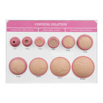 Cervical Dilation & Effacement Models (1–10 cm) for Childbirth ...