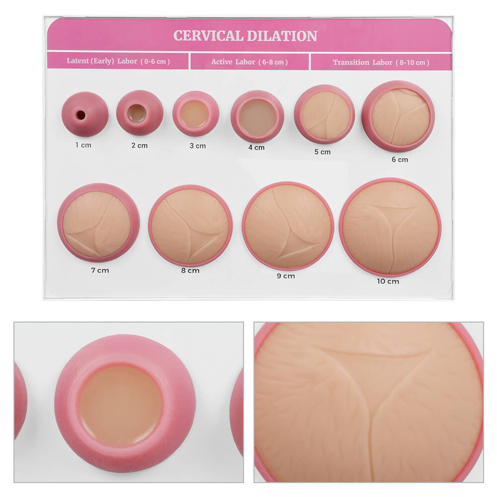 Cervical Dilatation and Effacement Models(10) with Easel Board Display