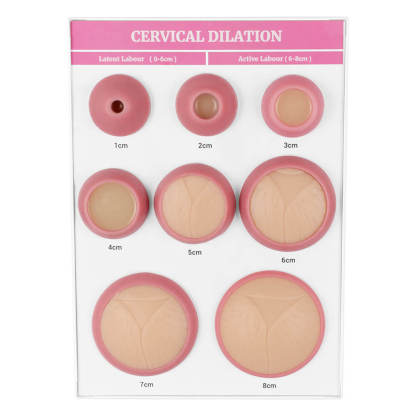 Cervical Dilation Models Set of 8 (A4 Base)