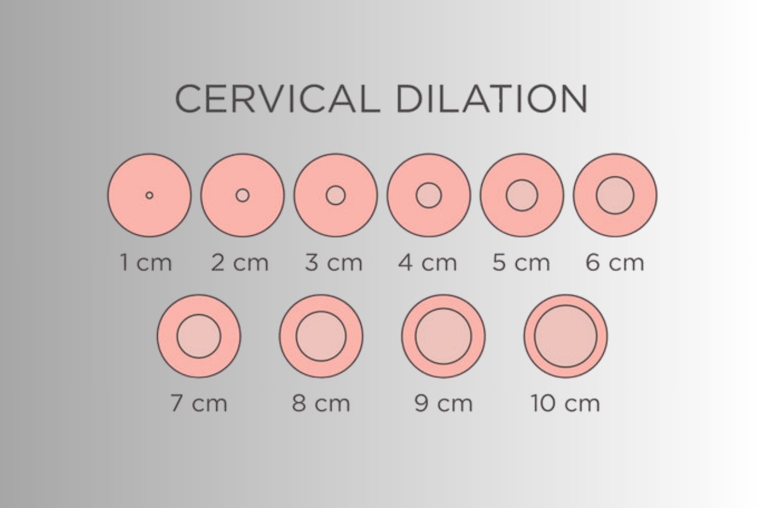 Cervical Dilation Chart: Understanding the Stages of Labor