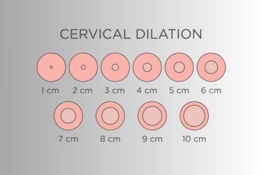 How to Check Dilation with Fingers: A Practical Measurement Guide ...