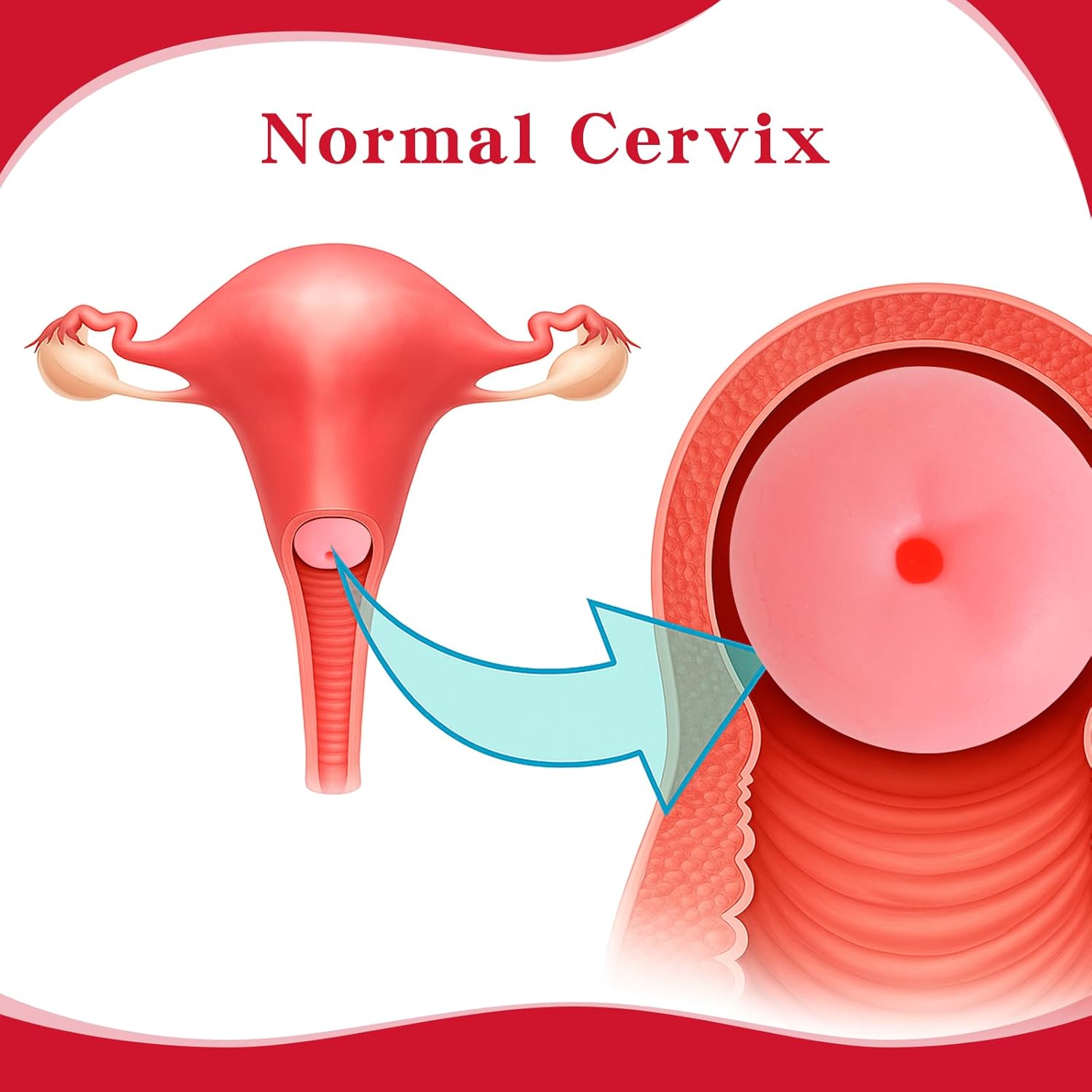 Cervical Pathology Model with 6 Cervical Replicas