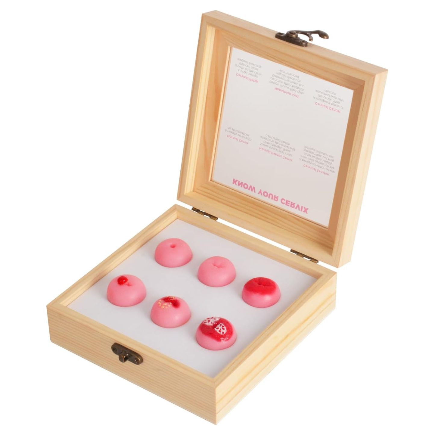 Cervical Pathology Model with 6 Cervical Replicas