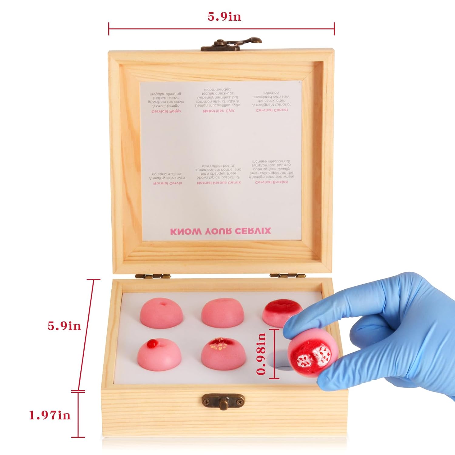 Cervical Pathology Model with 6 Cervical Replicas