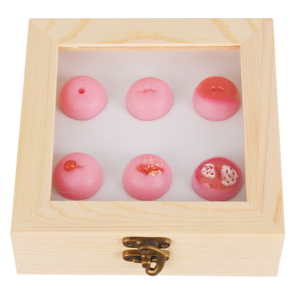 Cervical Pathology Model with 6 Cervical Replicas